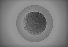 UCD Centre for Human Reproduction